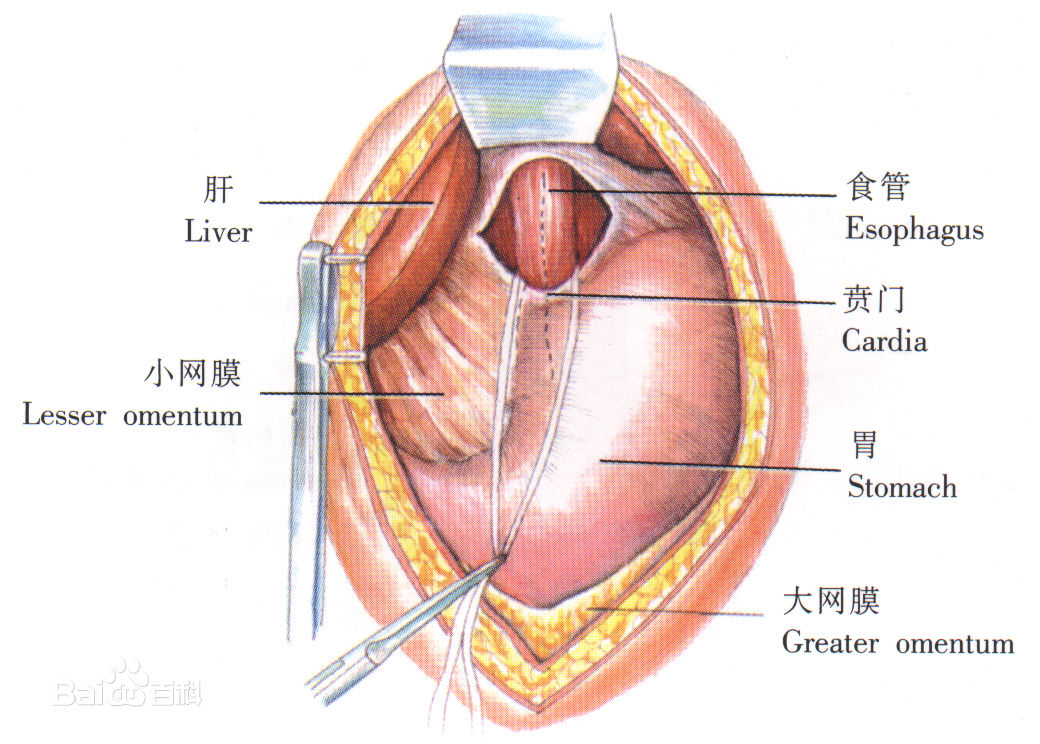 贲门癌