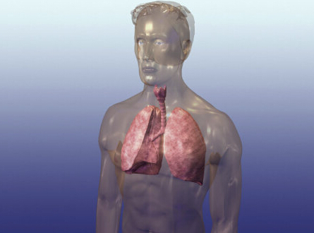 肺癌胸积水原因以及分类
