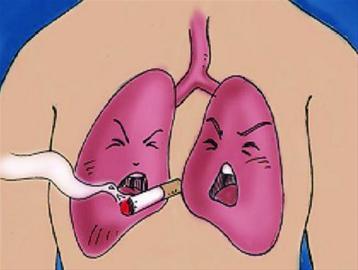 肺癌的临床分型
